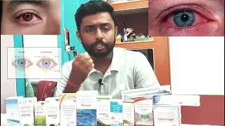 Common eye drop & eye ointment || common eye problems treatment 