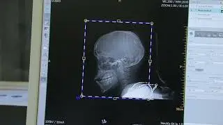Video News Release (KTRH)