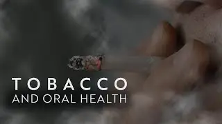 Tobacco and Oral Health
