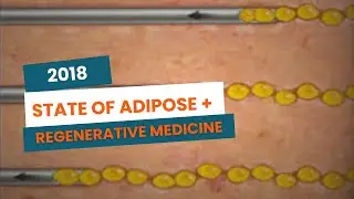 State of Adipose and Regenerative Medicine in 2018 | SDARTS