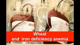 Wheat and iron deficiency anemia