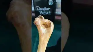 Humerus || Osteology ||MBBS || Medical student