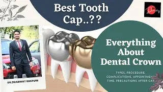 Dental Crowns/Cap | Procedure, Types, Cost | दांतो की कॅप |