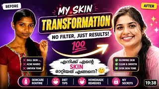 😍💯എന്റെ skin Transformation journey 🔥|Skin Transformation malayalam |Amz vlogs