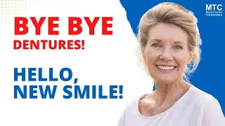 All on 4 Dental Implants in Tijuana, Mexico: ALL You Need To Know!