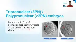 MSART Webinar Series 2024   #9 Alpha IVF & Women&rsquo;s Specialists