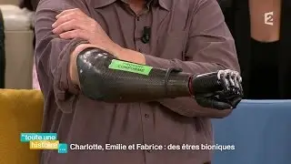 Vivre avec une main bionique au quotidien #touteunehistoire