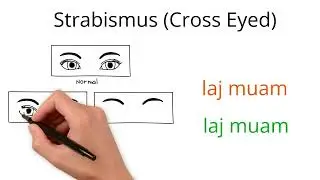 Common Eye problems in Hmong, part 1 #hmong #medical #terminology
