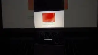 AI-Based Skin Burnt Prediction Using Python | Final Year Project 2026 #shorts