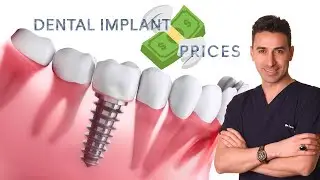 أسعار زراعة الأسنان 2019 اسطنبول تركيا ألفا دينتال كلنك Alfa Dental clinic