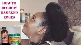 HOW TO REGROW DAMAGED EDGES AND HAIR|| NATURAL HAIR.