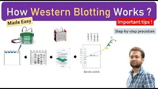 What is Western Blotting? How it works? Made easy