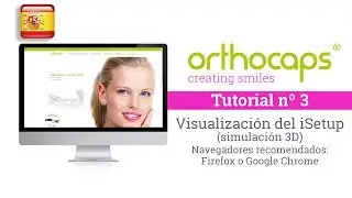 Orthocaps tutorials. Visualizaci&oacute;n del iSetup