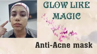 Mask for Acne | Green Tea mask | Anti acne mask