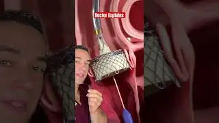 Doctor reacts to life saving procedure