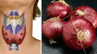 Thyroidka waxaa uron iyo waxaa sabaa doctor run halaga faideysto