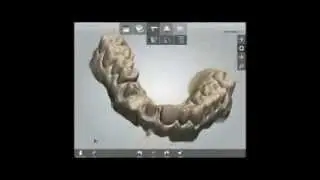 3 Shape Trios Benefits - Digital Impression System - Ceramics Dental Lab Miami