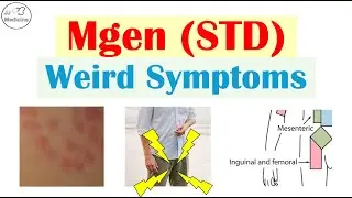 The STD You&rsquo;ve Never Heard Of: Weird Symptoms of Mgen (Doctors Miss These)