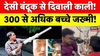 Carbide Gun : कार्बाइड गन और पटाखों की चपेट में आकर 91 लोगों की आंखें चोटिल | Diwali 2025 | Top News