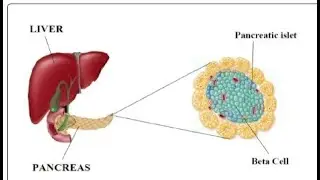Diabetes Mellitus:Part 1