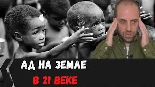 Антисанитария и голод 2020 // Глобальные проблемы человечества // To the left
