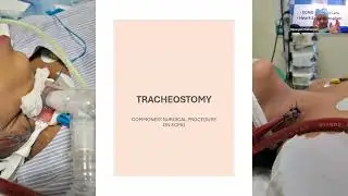 01 Surgical interventions during ECMO by Dr Dipanjan Ch ECMO INDIA OCT 2024 - Day 03