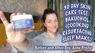 30 DAY SKIN CARE TEST: BAKUCHIOL {COCOKIND RESURFACING SLEEP MAKS} Before and After Dry, Acne Prone