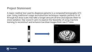 CT Image Reconstruction