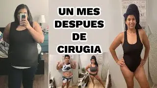 UN MES DESPUES DE MI CIRUGIA | ONE MONTH POST OP | COMO ESTA CAMBIANDO MI CUERPO