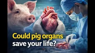 Why Pig Organs Transplants Are Closer Than Ever
