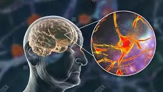 #Fluid Flow Analysis Meets AI #Advance Brain Health #shorts #viralscience