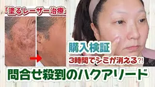 【問合せ殺到ハクアリード】3時間でシミが消える？インスタ広告のアレを購入検証！