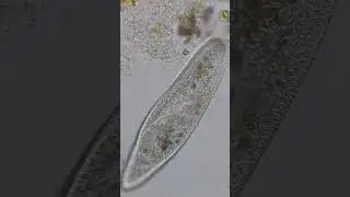 Cilia exposed! Extreme close up of a Paramecium, 400x #microscope #satisfying
