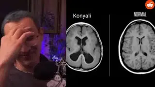 Çağrı abiye yakışmadı [Reddit Feti$i]