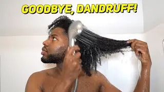 I USED ROYAL OILS FOR 1 MONTH | DANDRUFF WASH DAY