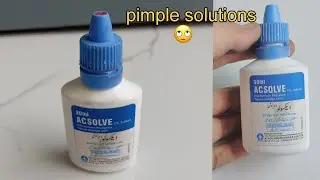 I Tried AC Solve Lotion For Pimples And Acne - Shocking results 😲