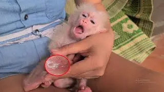 Baby monkey gets its nails trimmed by its mother, treated for dermatitis, and drinks milk