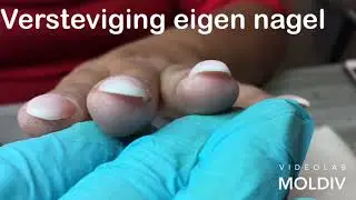 Polygel versteviging