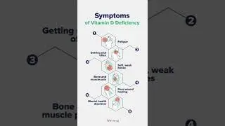 വിറ്റാമിൻ D കുറവാണോ? ഈ ലക്ഷണങ്ങൾ ശ്രദ്ധിക്കൂ | #vitamin #vitamind #shorts #healthy #skincare