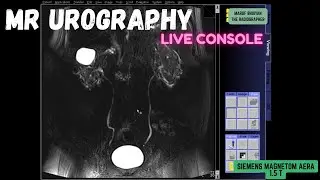 MR Urogram- Live Console Full Tutorial | SIEMENS MRI |