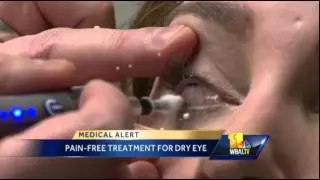 Dr. Brett Levinson presents BlephEx™ on WBAL-TV