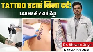 Laser से Permanent Tattoo Removal कैसे होता है? Dr. Shivam Goyal ने बताया बिना दर्द का इलाज!
