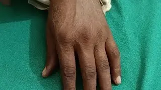 wrist stiff exercise, wrist range of motion exercise