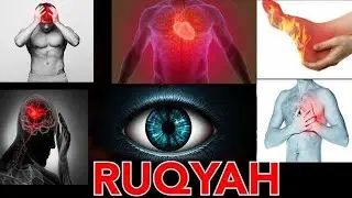 Ruqyah Shariah for Evil eye, Envy and Magic - Beautiful - Peaceful - Abdul Wali Al-Arkani