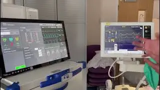 CRITICAL CARE SIM: Managing a Patient on Mechanical Ventilation with using #LeonardoHF