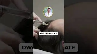 Does PRP Really Work for Hair Growth? | PRP Hair Treatment Explained #shorts