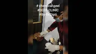 # chemical peel #yellow peel @dr.diptigeneralphysicianco9667