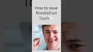 What to do when you knocked out a tooth 🦷 #dentist #information #viralvideo #viral #viralreels