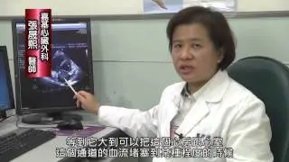 久咳不癒，原是心臟黏液瘤