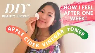DIY APPLE CIDER VINEGAR TONER FOR ONE WEEK! | ACV Toner Recipe | Easy Acne Solution